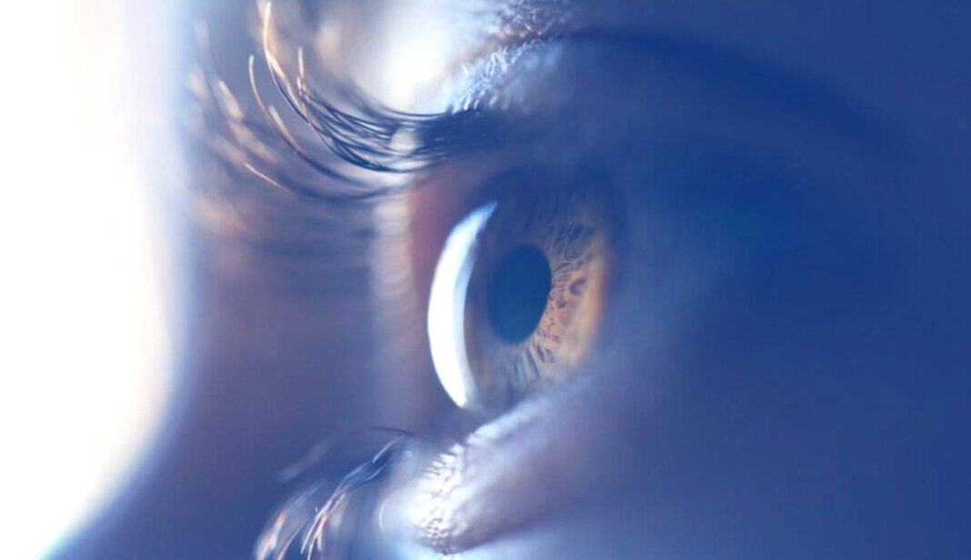 काला मोतिया, समय रहते पहचानें, एक बार गई नजर वापस नहीं आती