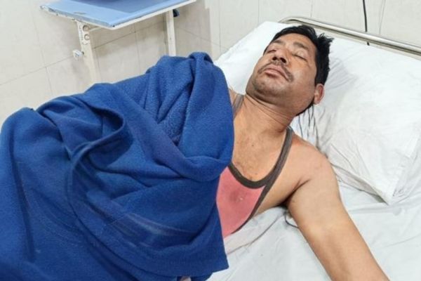 रामगढ़ के इस्पात प्लांट में ब्लास्ट, 9 मजदूर झुलसे, 7 की हालत गंभीर इस्पात