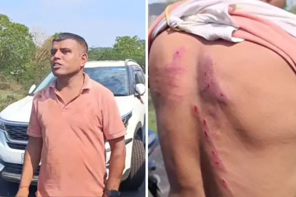 धनबाद में कोयला चोरों का हमला, ASI और पत्नी गंभीर रूप से घायल कोयला